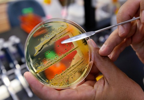 Dr. Mansour Samadpour points out a growth of salmonella in a petri dish at IEH Laboratories Monday, May 17, 2010, in Lake Forest Park, Wash. THE CANADIAN PRESSS/AP-Elaine Thompson