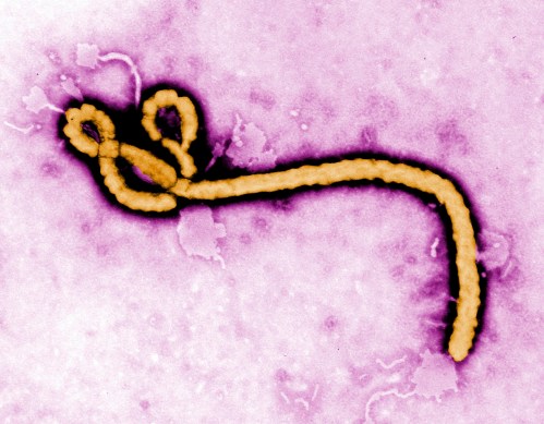FILE - This undated colorized transmission electron micrograph file image made available by the Centers for Disease Control and Prevention (CDC) shows an Ebola virus virion. (Frederick Murphy/CDC via AP, File)