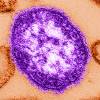 This undated image made available by the Centers for Disease Control and Prevention on Feb. 4, 2015, shows an electron microscope image of a measles virus particle, centre. THE CANADIAN PRESS/AP-Cynthia Goldsmith/Centers for Disease Control and Prevention via AP