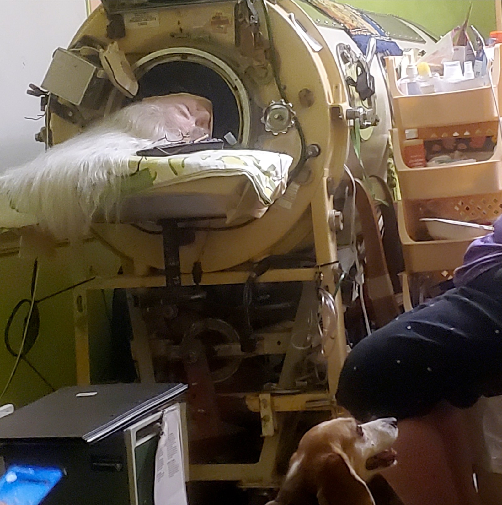Martha Lillard, last US polio patient using iron lung, dies at 78 in Oklahoma